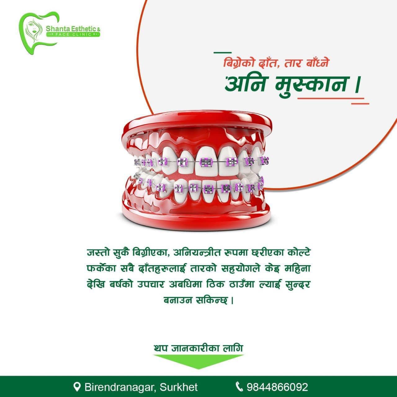 Orthodonotics Braces at Shanta Dental - Best Dental Clinic in Surkhet