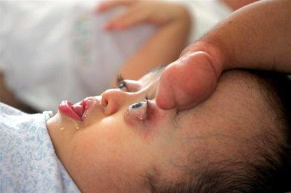 Lanka Gossip The Effects Of Agent Orange In Vietnam