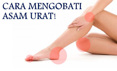 Obat Asam Urat Alami