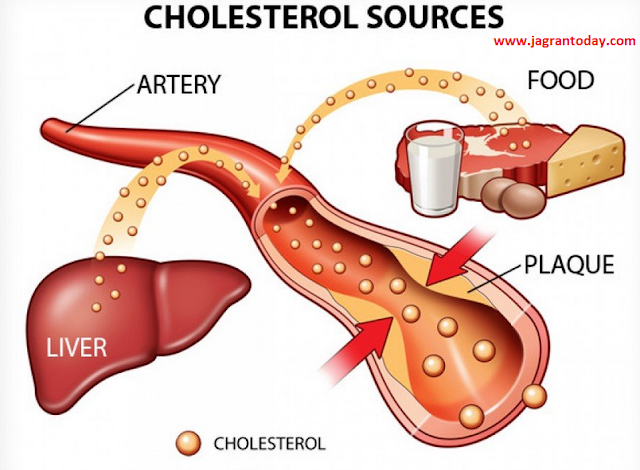 Control Cholesterol by Home Remedies