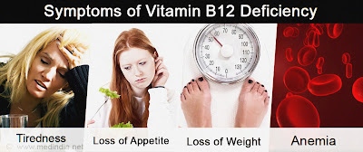 Top Vitamin B 12 deficiency signs and symptoms