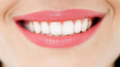 Những phương pháp tẩy trắng răng phổ biến