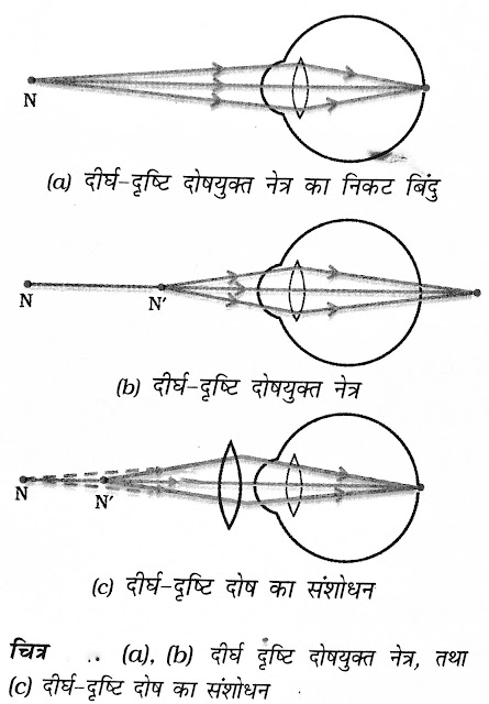  दीर्घ दृष्टि दोष