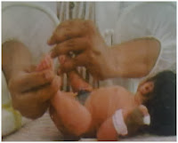 Pijat bayi pada bayi kurang bulan (PREMATUR)