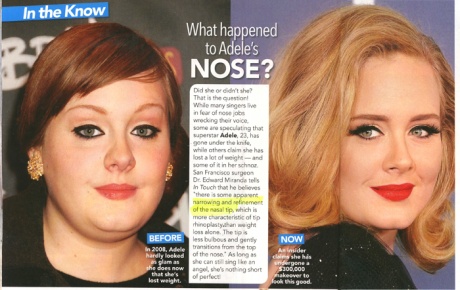 In conclusion, the famous singer Adele nose job is said to be fine. It ...