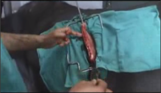 Teknik Operasi Gastrotomy & Rumenotomy pada Hewan (Bedah Digesti)