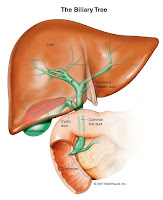 Penyakit liver dan cara mengobatinya lengkap