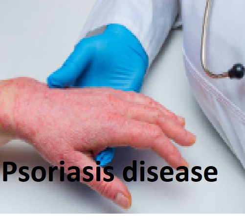 Psoriasis Disease
