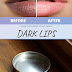 GET Light Color Lips – Turn Black Lips To Natural Pink