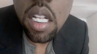 kanye West Diamond Teeth picture