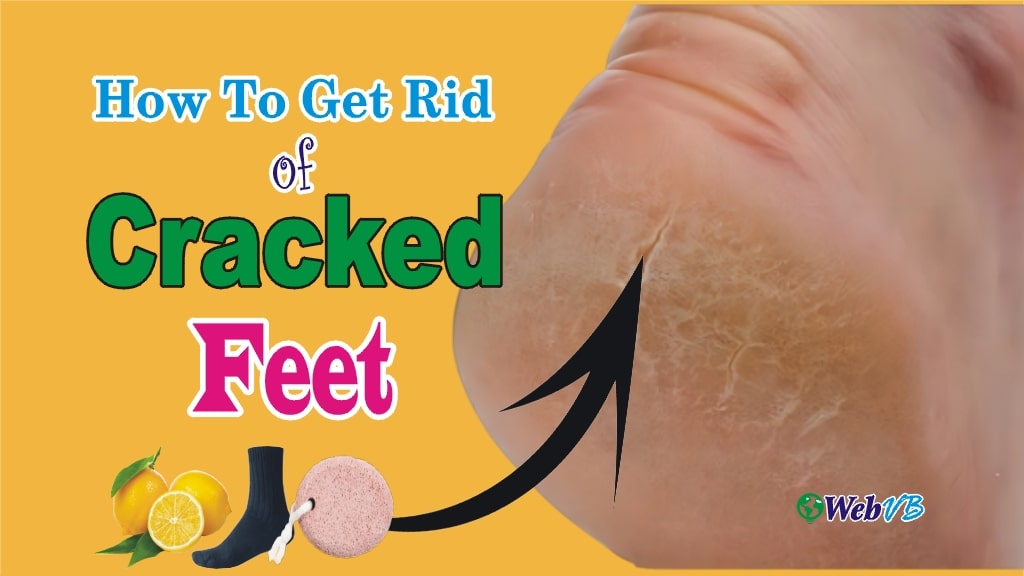 How To Remove Dry Cracked Feet