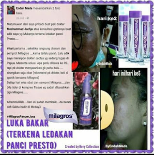 Milagros Untuk Luka Bakar