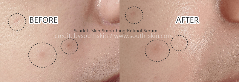 review-scarlett-skin-smoothing-retinol-serum-southskin