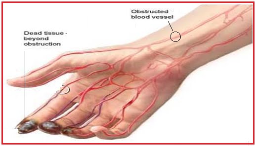 human veins and arteries diagram. human veins and arteries