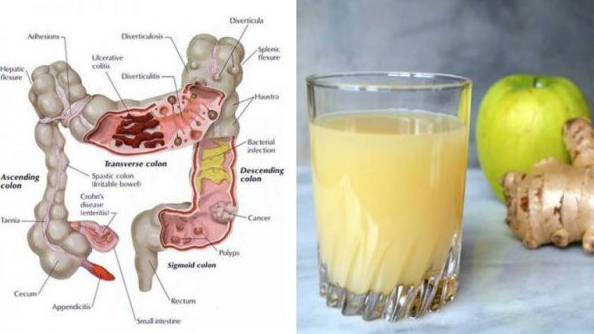 Flush 28 Pounds Of Toxins From Your Body With This Powerful Juice Recipe