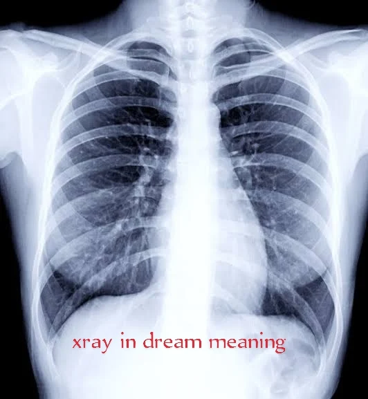 Recent,X,Dream about an x-ray meaning,