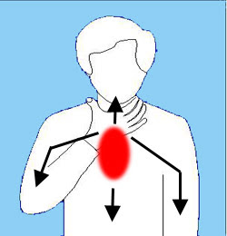 مرض نقص التروية القلبية الذبحة الصدرية Heart Disease Angina Pectoris