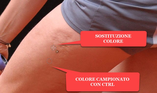 cerotto di gimp per cellulite