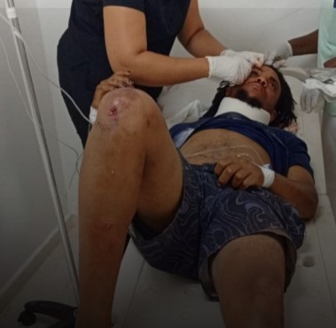 Conductor de motocicleta deslizamiento en la fuente de Samaná 