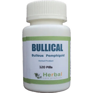 Herbal Treatment for Bullous Pemphigoid