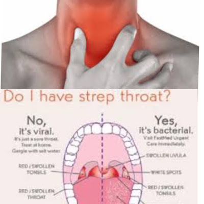 What is an aggravated throat? And 8 explanations behind sensitive throats.