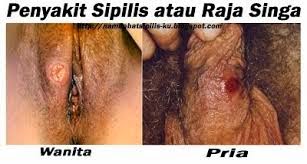 obat sipilis