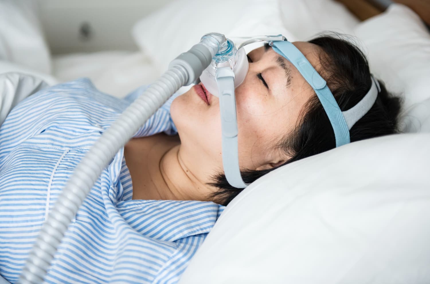 Sleep apnea implant works well for overweight people: study