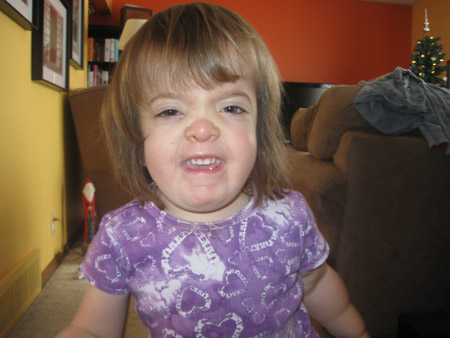 Lauren, Roman, Us - Living with Noonan Syndrome: Following the herd