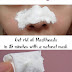 Get Rid of Blackheads With Glue And Other Remedies