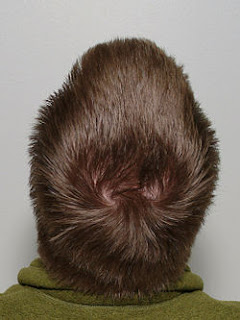 Natural Hair Regrowth