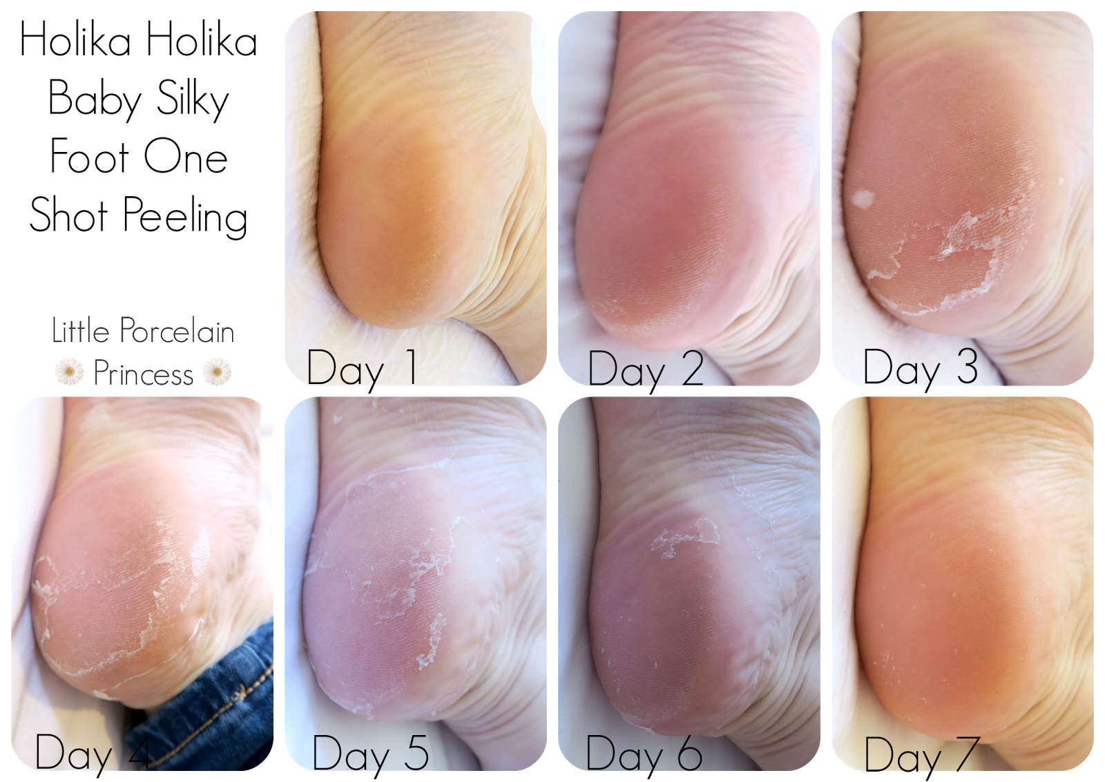 Baby Foot Peel Review - What to Know About Baby Foot Peel and If