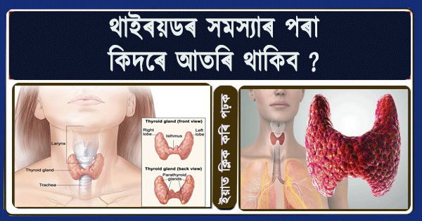 thyroid problem solution in assamese