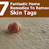 7 Fantastic Home Remedies To Remove Skin Tags