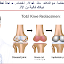 جراحة استبدال المفاصل مع الدكتور ياش غولاتي أخصائي جراحة العظام في دلهي يجعل حياتك خالية من الألم