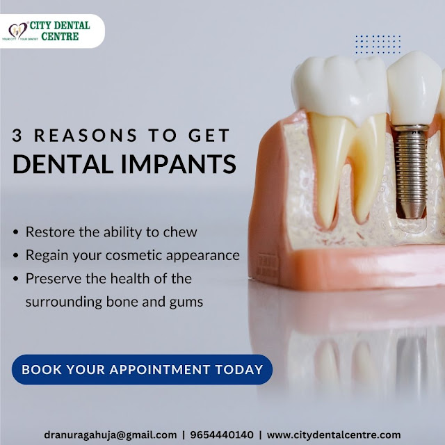 Dental Implant cost in Noida
