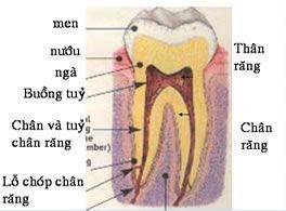 Phân tích bọc răng sứ có lấy tủy không từ nha sĩ-1