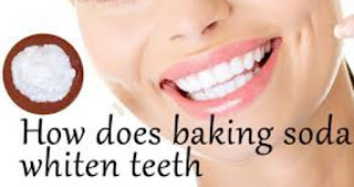 Does Baking Soda Whiten Teeth