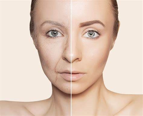 How To Tighten Skin After Weight Loss Naturally