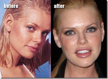 sophie monk plastic surgery
