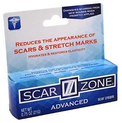 scar removal remedies