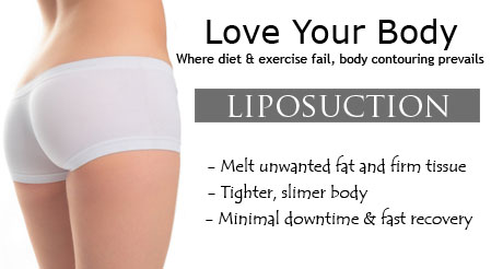 liposuction in delhi