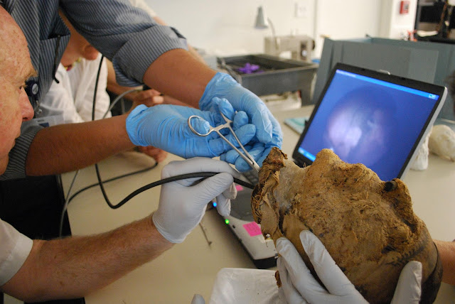 Ученые и врачи извлекают зуб из мумифицированной головы