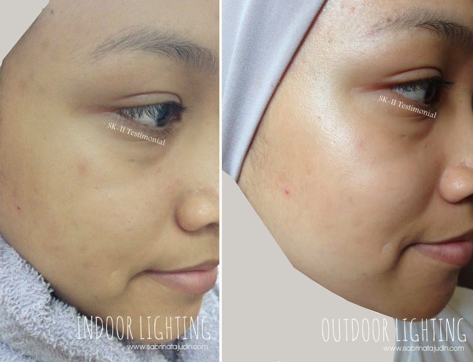 Sk Ii Pitera Facial Treatment Essence 14 Days Later Sabrina Tajudin Malaysia Beauty Lifestyle Blog