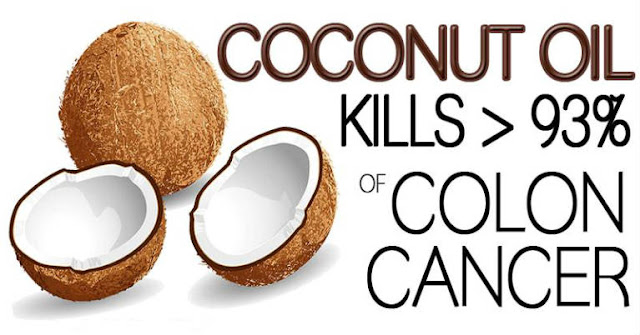 Even The Doctors Are Shocked: Coconut Oil Kills 93% Of Colon Cancer Cells In a Very Short Time