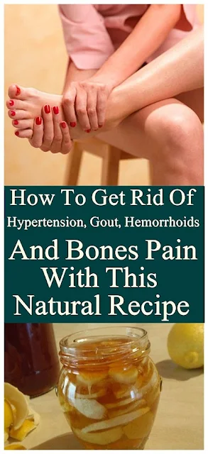 How To Get Rid Of Hypertension, Gout, Hemorrhoids And Bones Pain With This Natural Recipe