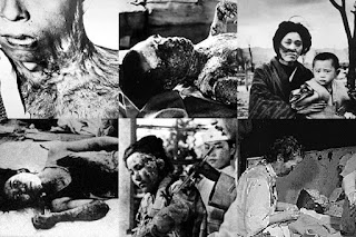 Image result for health effects of the hiroshima bombing