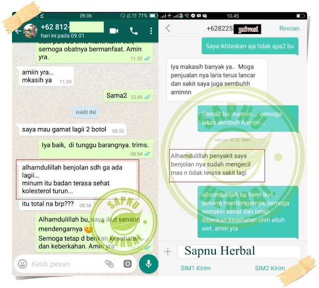 Cara Menghilangkan Benjolan Di Kepala