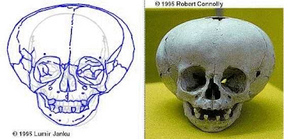 Huge headed Skulls found in Mexico, possibly not of this World