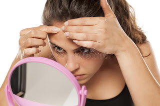 Home REMEDIES can I remove pimples on my face?