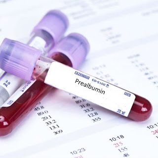 What is Prealbumin - Level, Ranges, Test  prealbumin vs Albumin